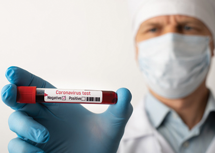 Teste depistare coronavirus