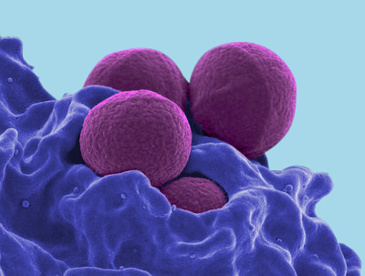Stafilococul_auriu_poate_fi_depistat_cu_ajutorul_exsudatului_nazofaringian