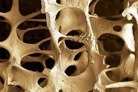 osteoporoza analize)